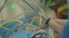 Dr. David Wilber performs a procedure called catheter ablation to treat patients with atrial fibrillation at Loyola University Medical Center in Illinois